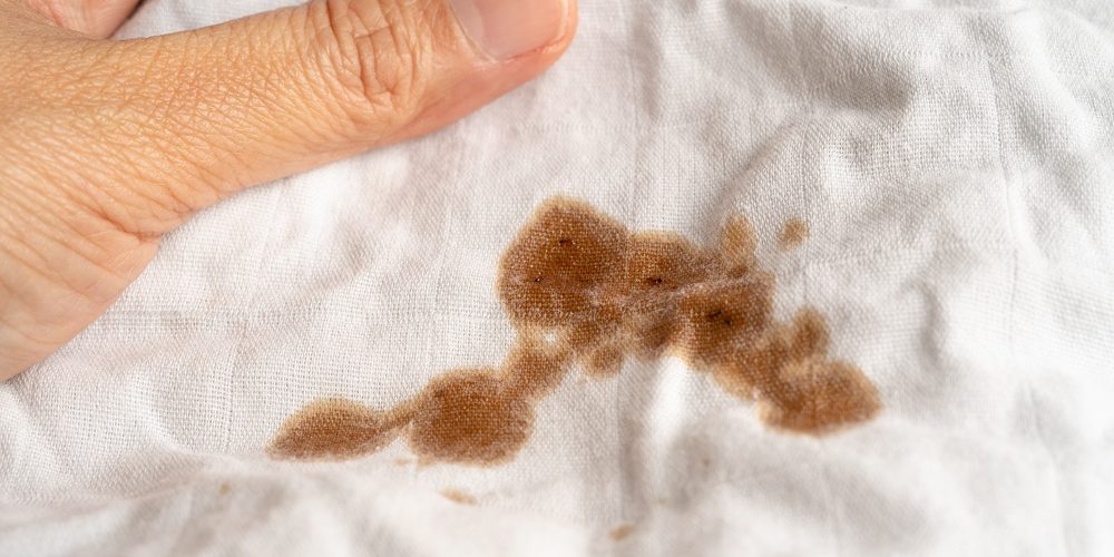 Which Stains on White Clothes Require Dry Cleaning?