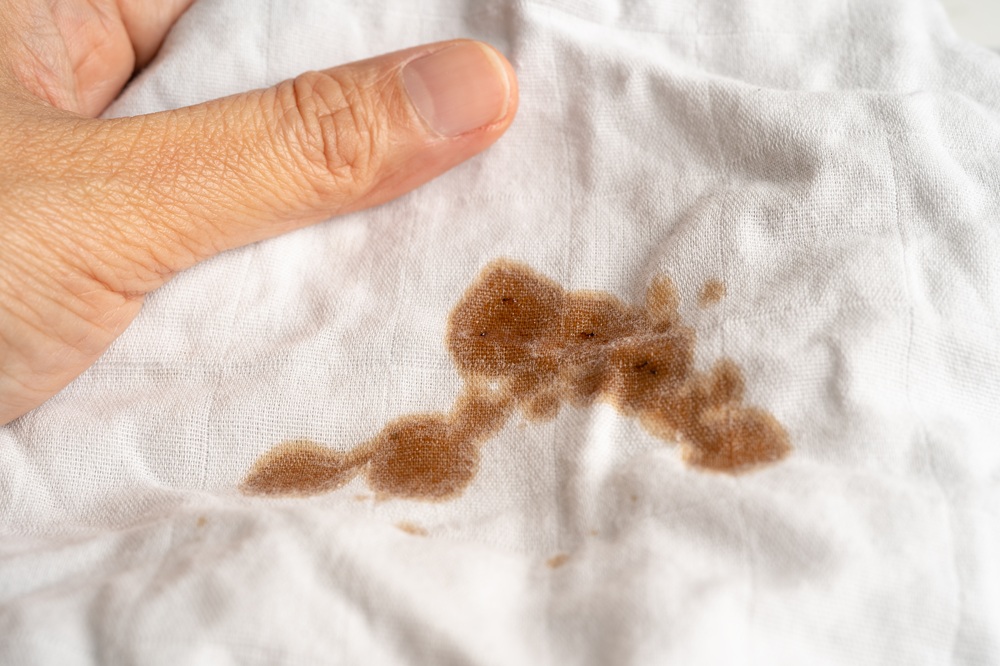 Home 54 Which Stains on White Clothes Require Dry Cleaning?